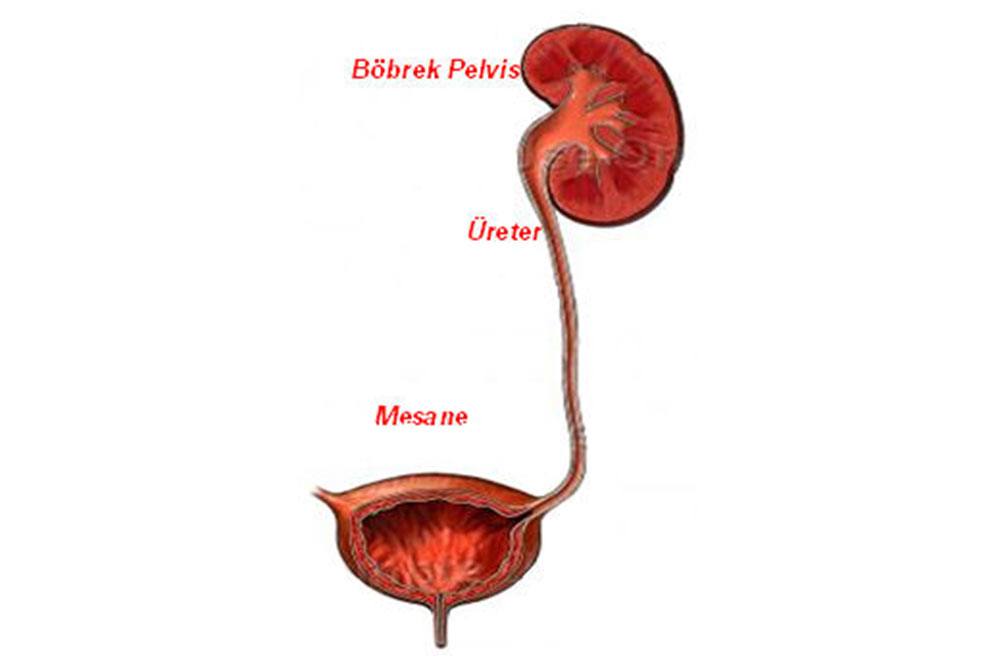 üreter kanserleri