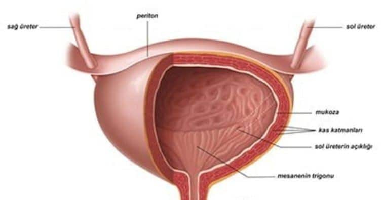 kadınlarda sistit nedir, sistit nasıl tedavi edilir